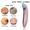 5 In 1 Blackhead Remover Machine Rechargeable Pore Cleaner - Skincare Device Designed For Pore Cleansing And Daily Beauty Routine
